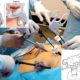Prostatectomía radical laparoscópica para el cáncer de próstata